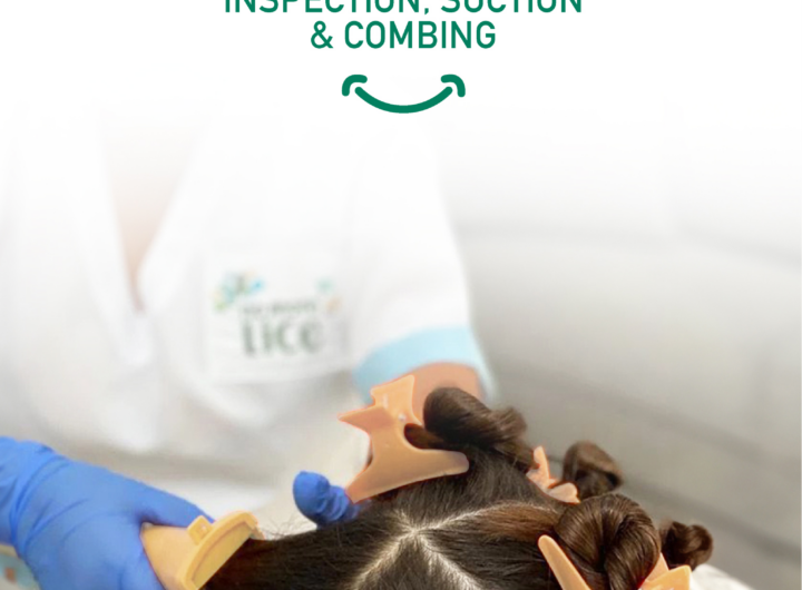 Tips To Choose The Right Lice Treatment Products